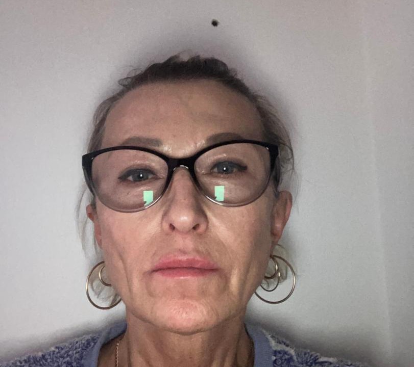 Photo of Human In Picture in Dagenham