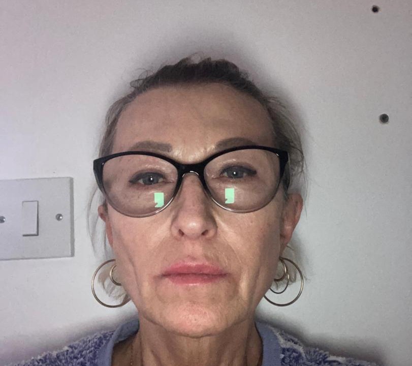 Photo of Human In Picture in Dagenham